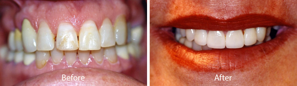 Dental before and after photos